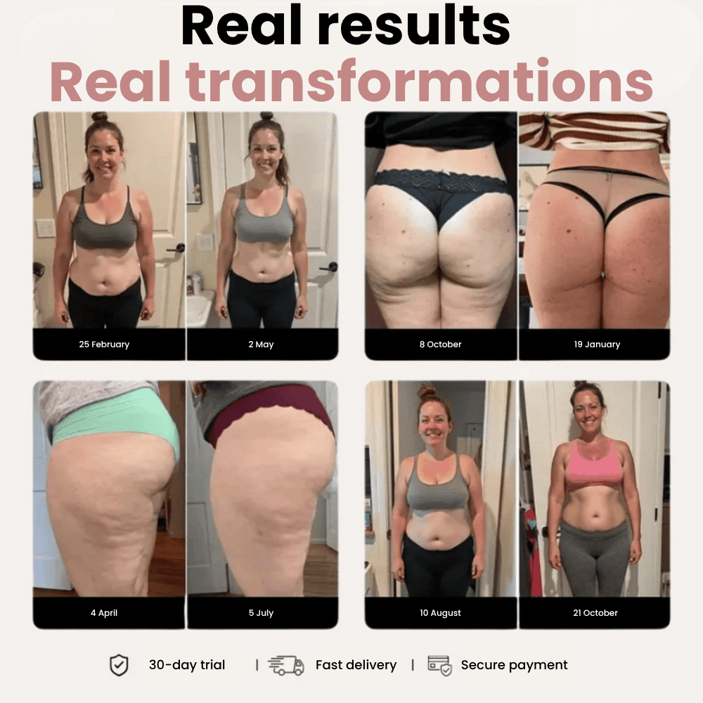 CelluFree 3D Legging – Redefine your silhouette effortlessly