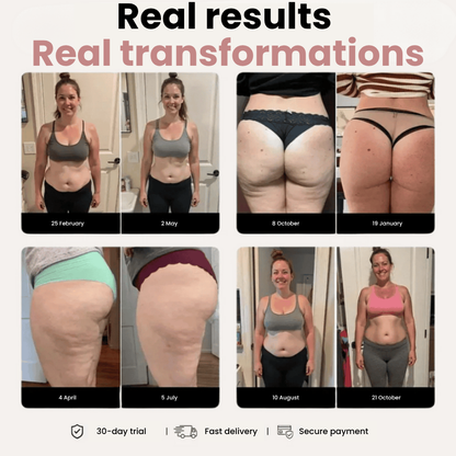 CelluFree 3D Legging – Redefine your silhouette effortlessly